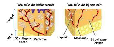 tr_rn_da_ninh_bnh_3